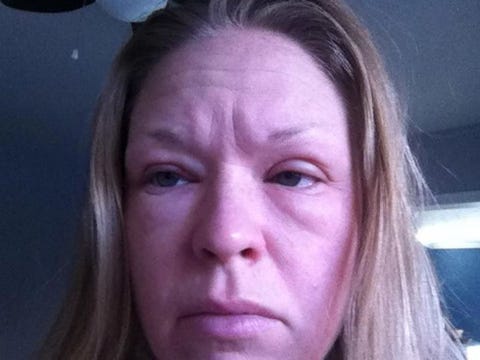 Consumers Say This Super Por Cleanser Burned Their Skin Image