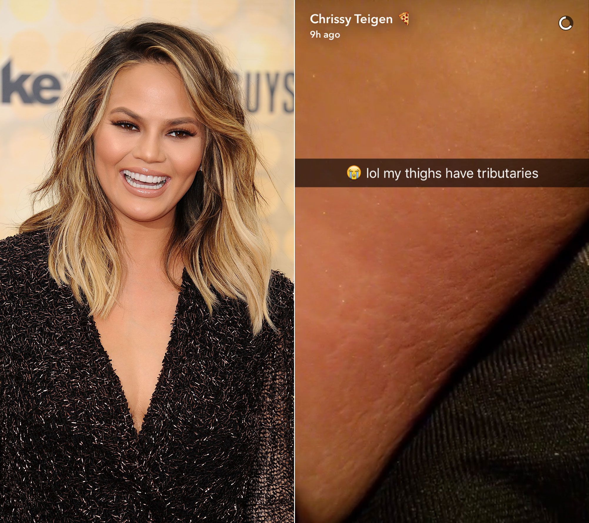 Celebrities With Stretch Marks Photos