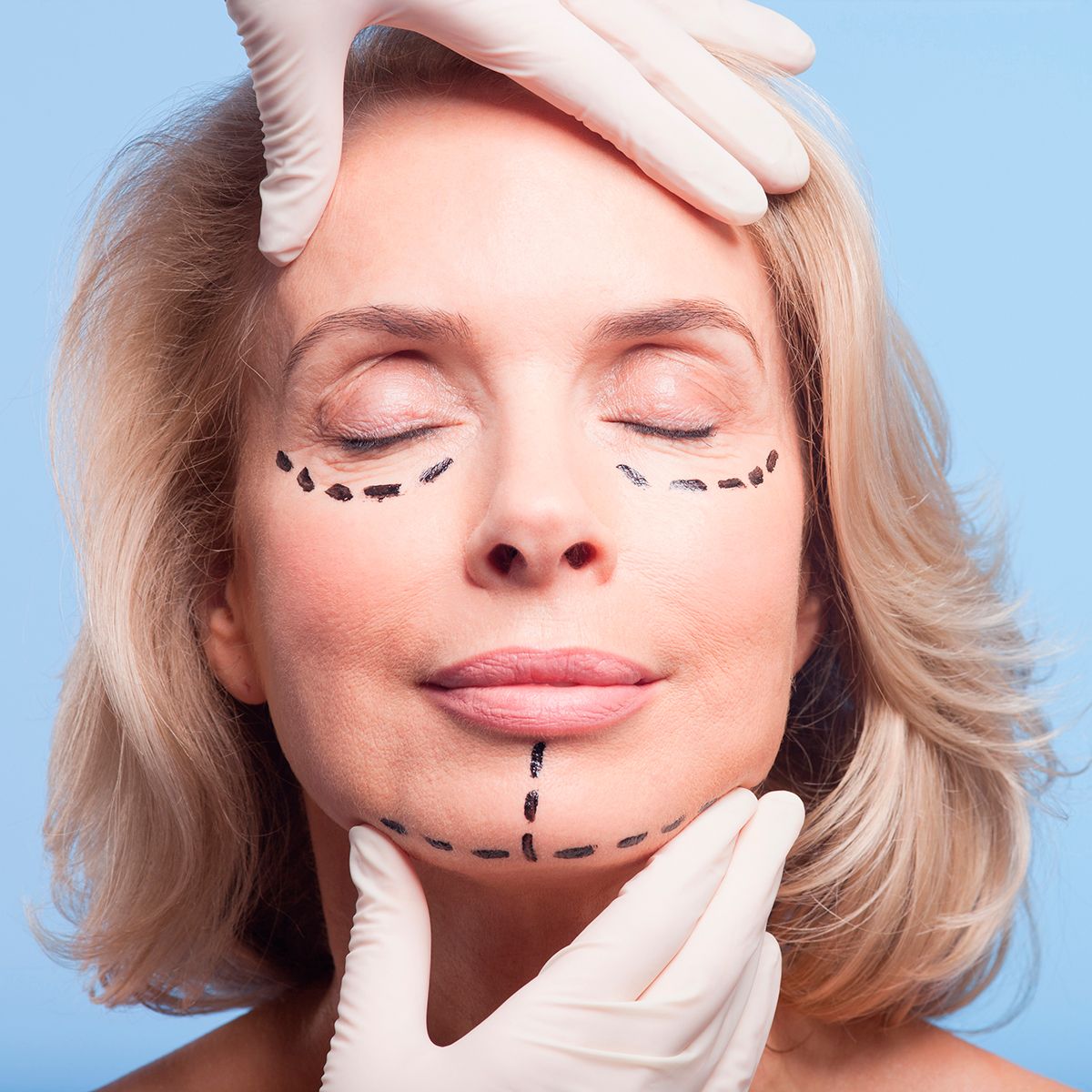 eyelid surgery uk