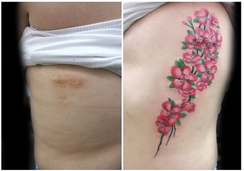 This tattoo artist covers up the scars of domestic abuse victims with her artwork for free This tattoo artist covers up the scars of domestic abuse victims with her artwork for free