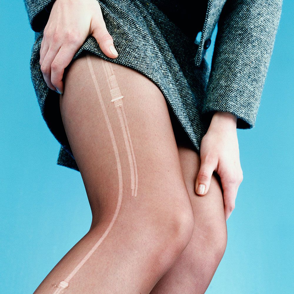 Does the hack to prevent tights from