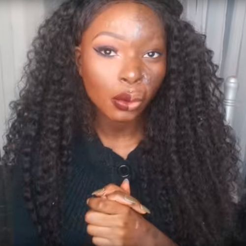 Burns survivor posts inspiring video showing how she covers her scars Burns survivor posts inspiring video showing how she covers her scars