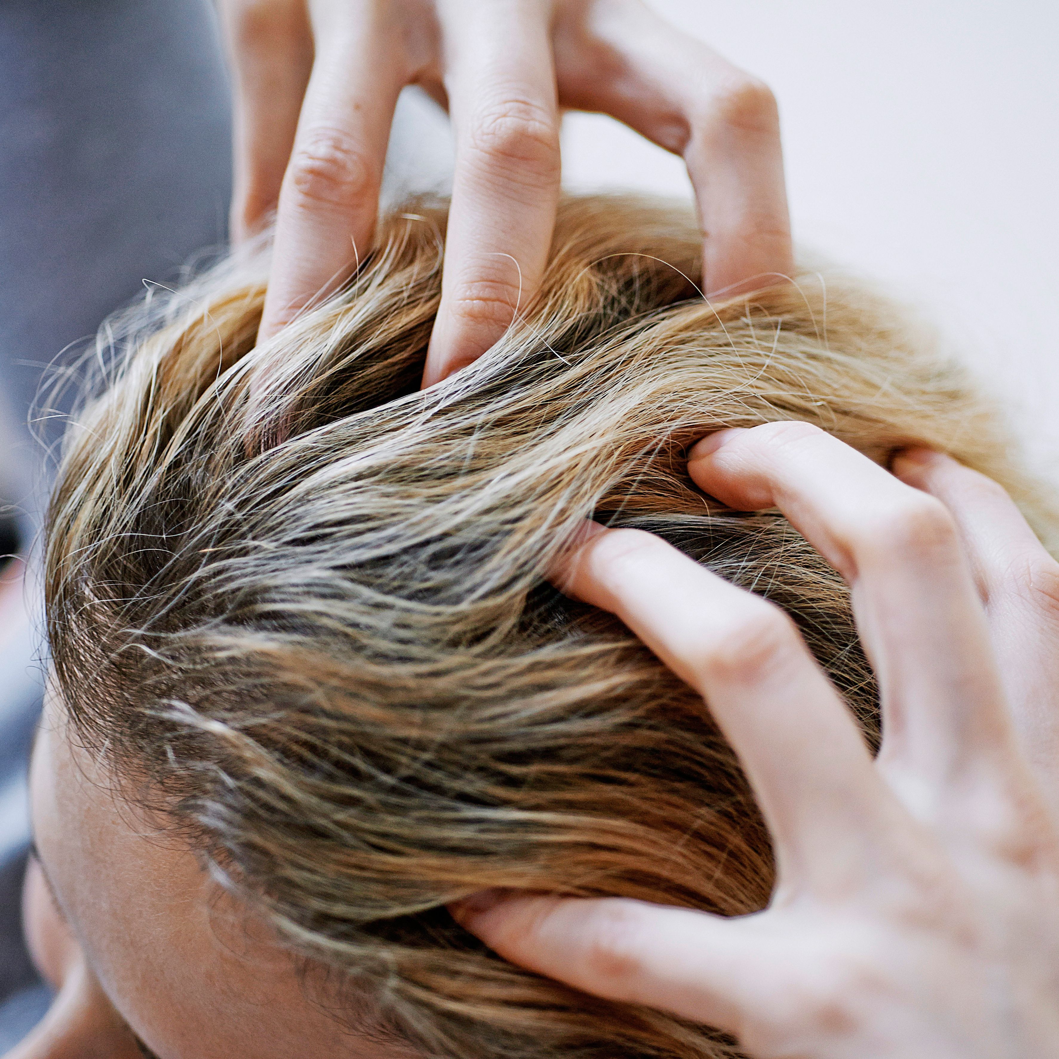 How to get rid of greasy hair