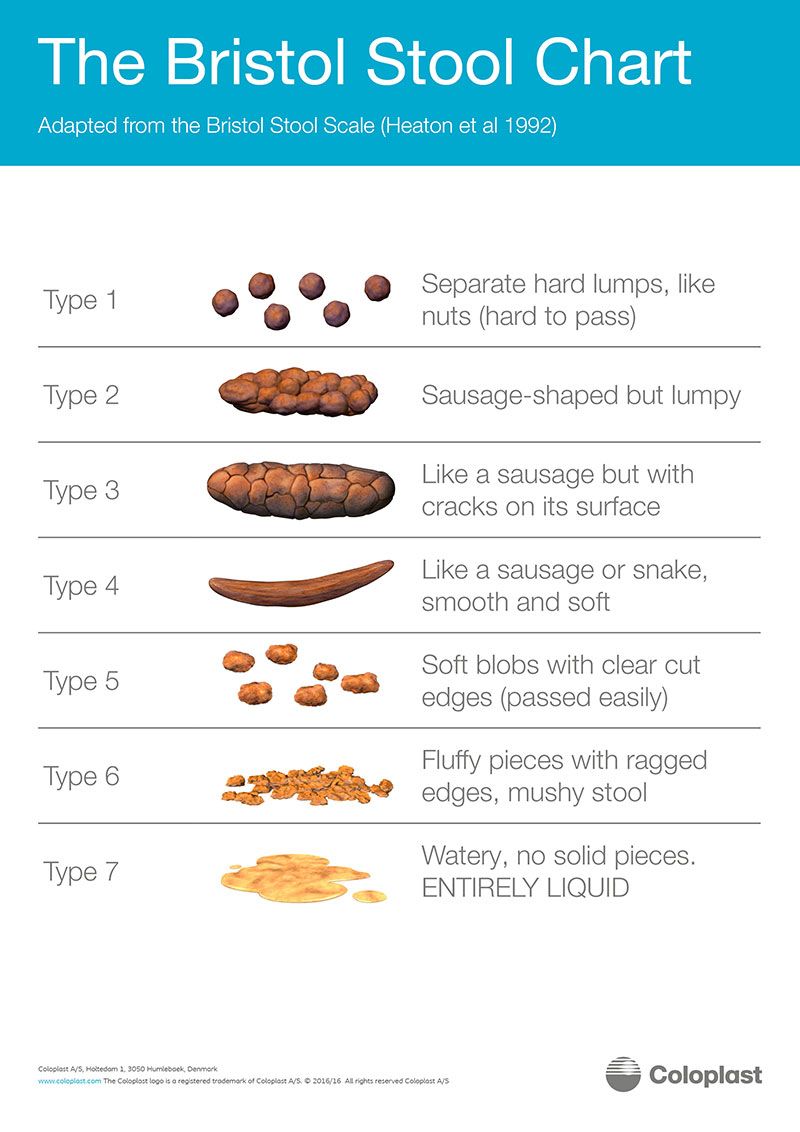 Bristol Stool Chart - what does poo and bowels say about health