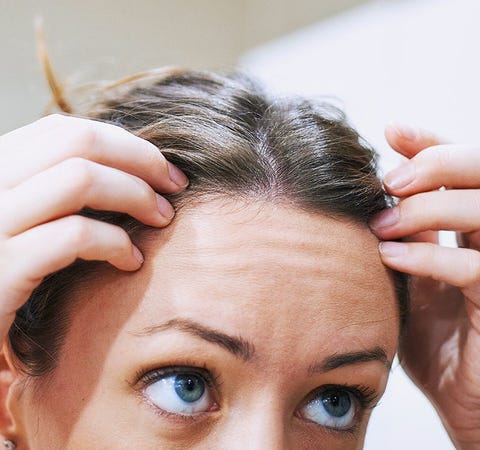 Female pattern hair loss: How to promote hair growth - How to promote hair growth when you have female pattern hair loss Female pattern hair loss: How to promote hair growth - How to promote hair growth when you have female pattern hair loss