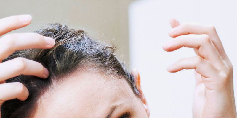 14 Things You Should Avoid If You Have Thinning Hair Hair Loss Mistakes