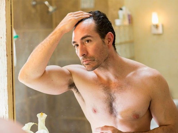6 ways to slow down hair loss 6 ways to slow down hair loss
