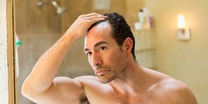 Receding Hairline How To Fix It