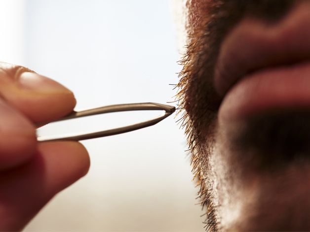 Ingrown hairs: how to spot and remove them