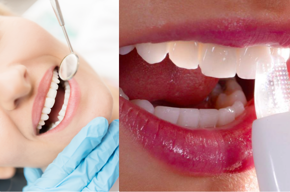 Tooth, Lip, Jaw, Mouth, Skin, Facial expression, Smile, Organ, Chin, Cosmetic dentistry, 