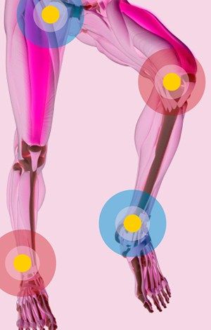 Joint, Pink, Purple, Magenta, Art, Violet, Colorfulness, Muscle, Knee, Graphics, 