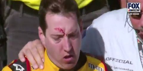 Kyle Busch ended up with a bloody forehead after a post-race incident on Sunday.