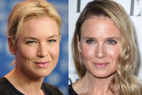 La Nuova Faccia Di Renee Zellweger Non Ha Niente Di Sbagliato