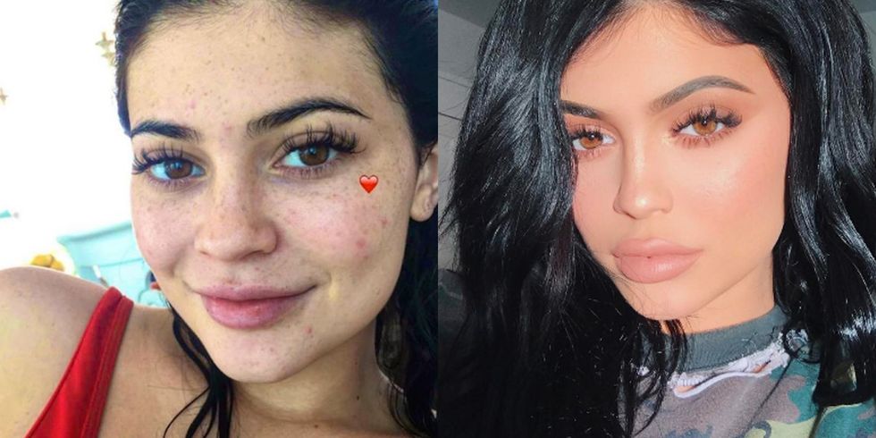 <p>Fun fact: Kylie Jenner's been hiding freckles this whole time. </p>