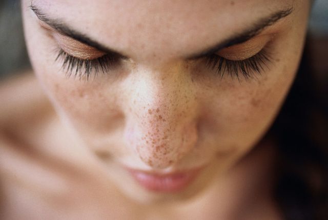 woman's face with freckles