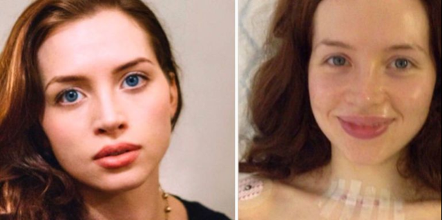 英女優が「ガンの兆候」写真を公開