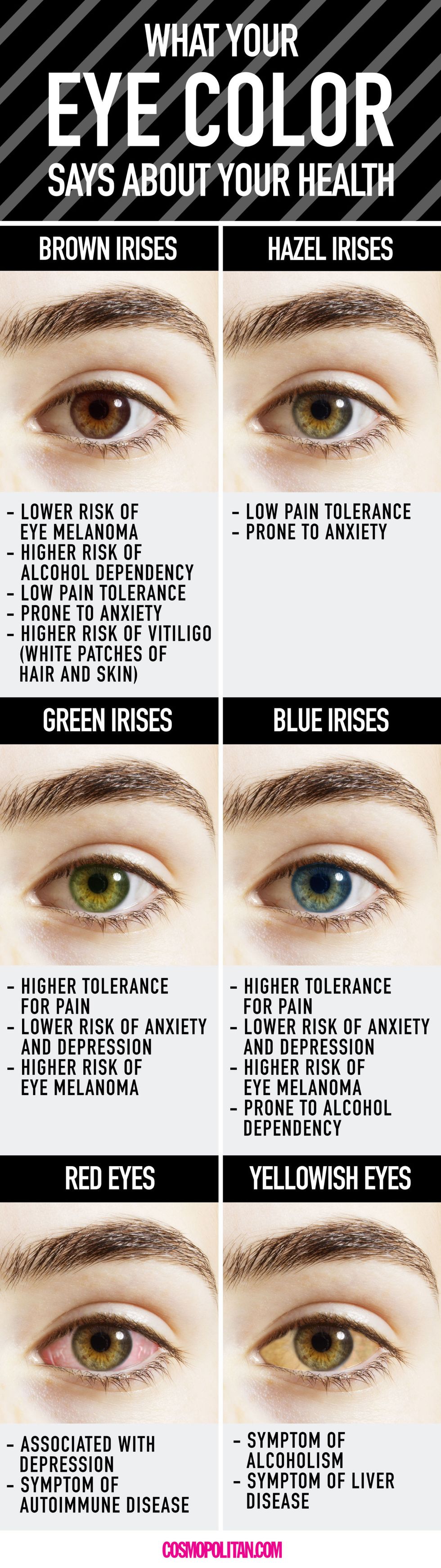 Wat je oogkleur zegt over je gezondheid