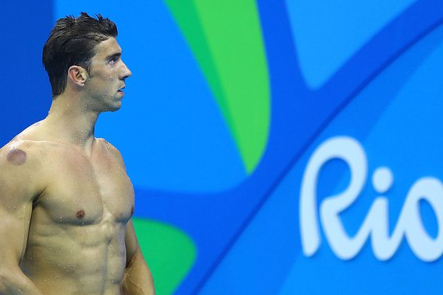 Michael Phelps cupping