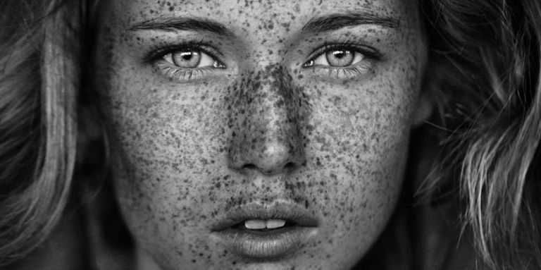 11 Stunning Portraits That Show Just How Beautiful Freckles Are