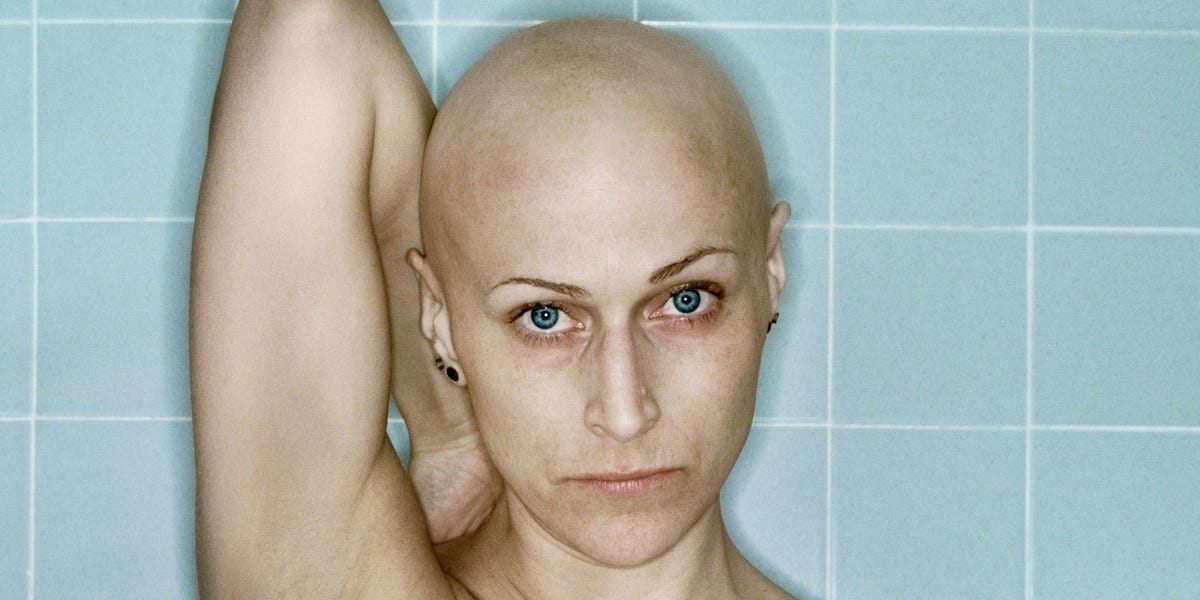 15 Raw Photos of a Woman's Breast Cancer Treatment