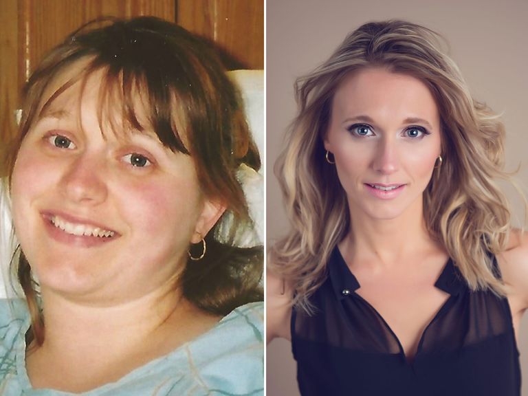 These Extreme Before After Photos Show How Far People Will