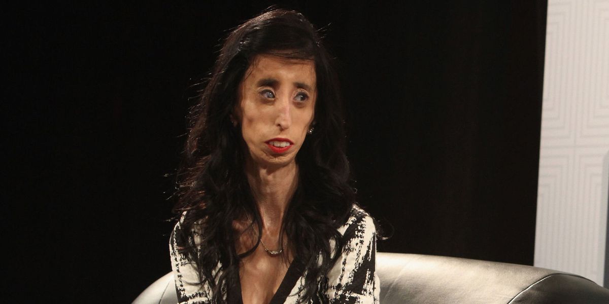 The Woman Who Went Viral as "the World's Ugliest Woman" Talks About Her