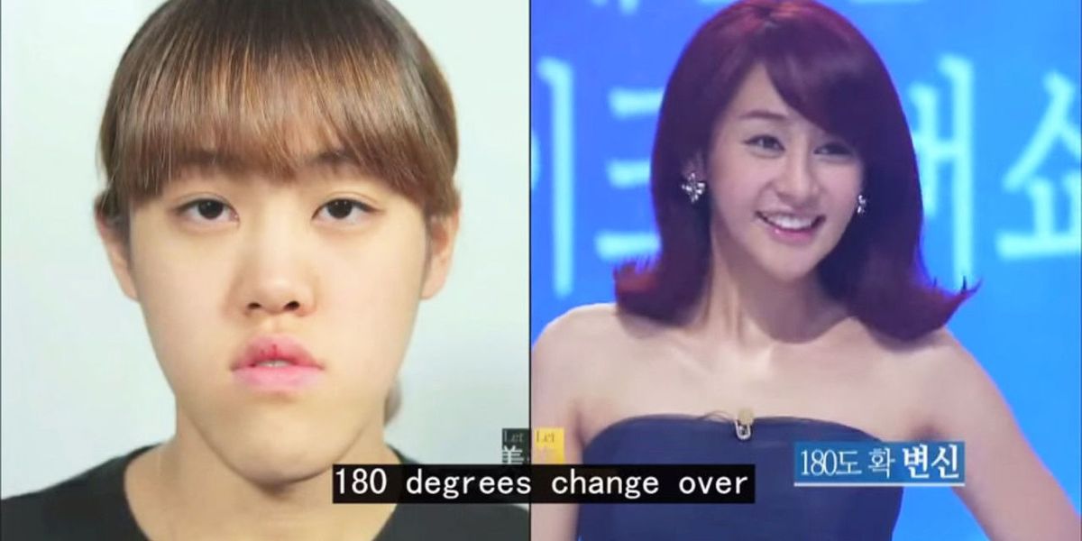 This South Korean Plastic Surgery Makeover Show Is the