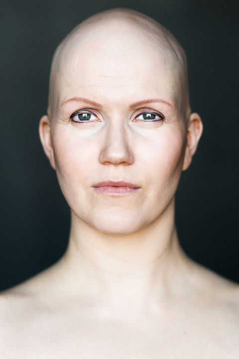 7 Brave Beautiful Photos Of Women With Alopecia