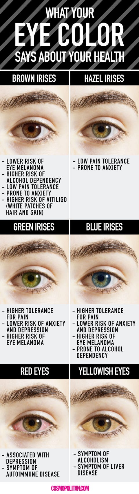 Different kinds of hazel eyes