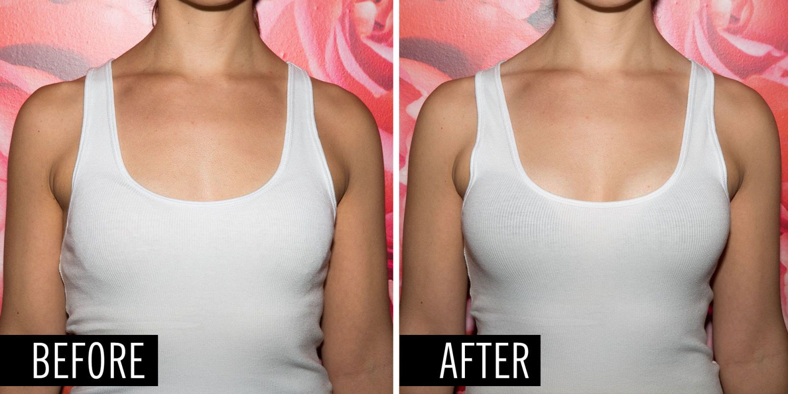 pommie girl breast augmentation add