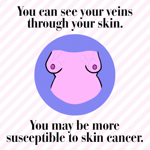 aww its ache boobs Aww its ache boobs