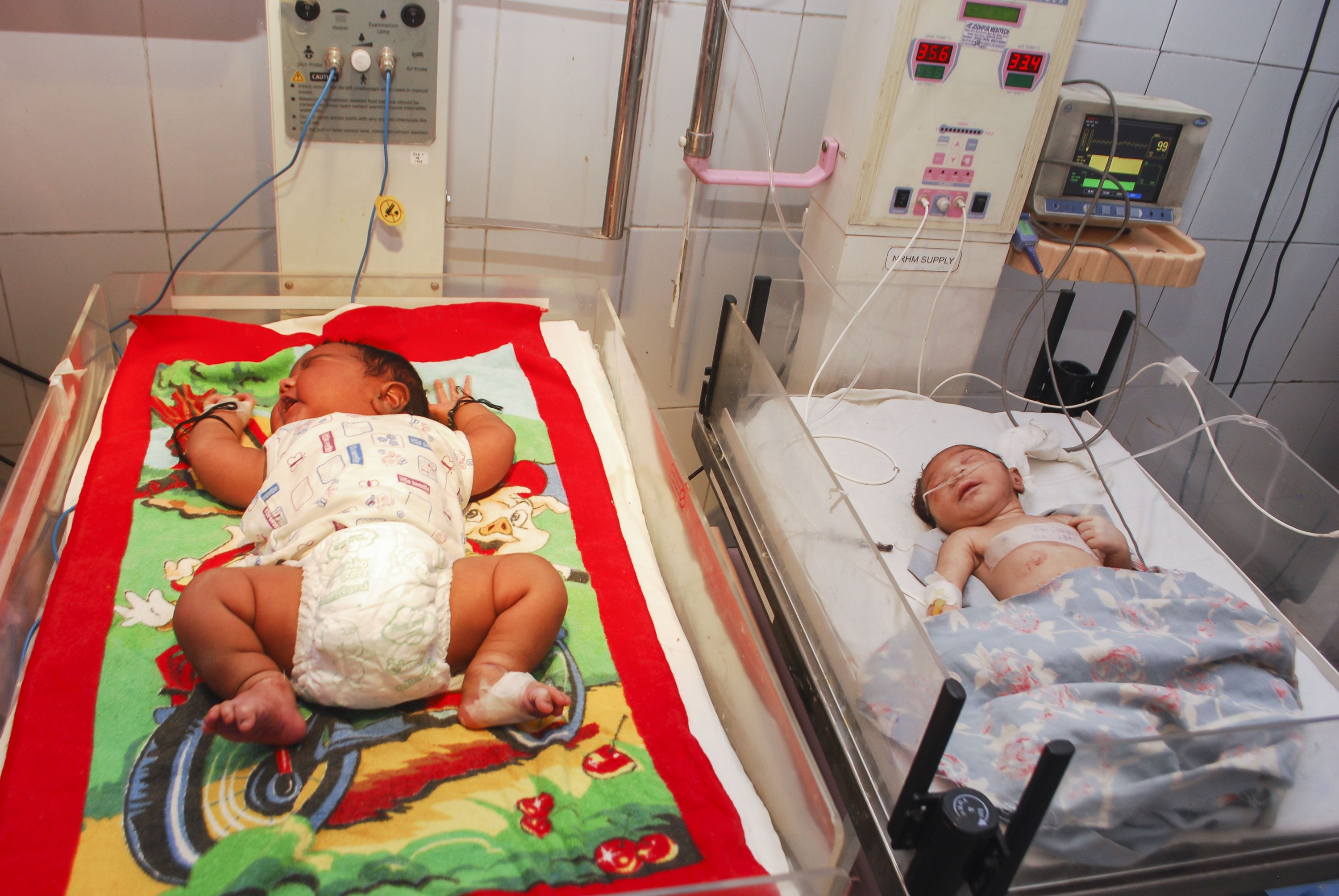 Mum Gives Birth To 'heaviest Baby' In India, Weighing 15lb BBC News ...