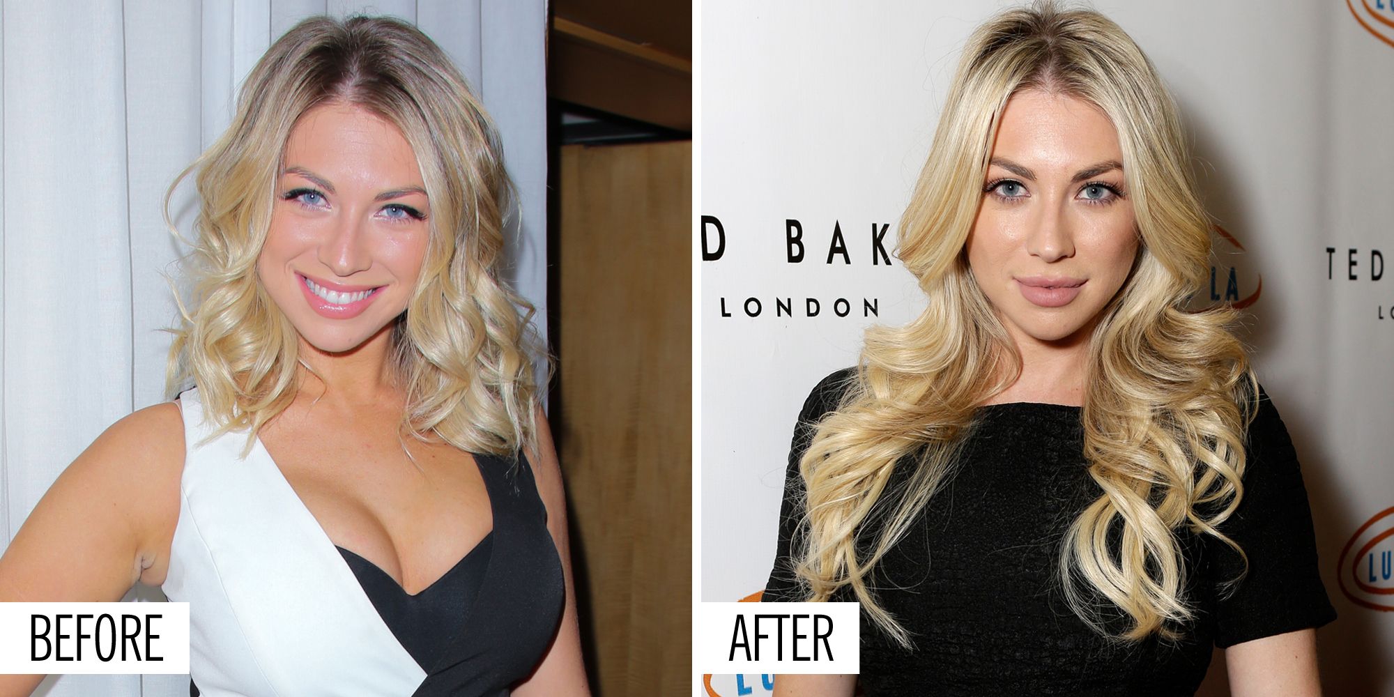 stassi schroeder plastic surgery - www.astrologermanavsharmaji.com.