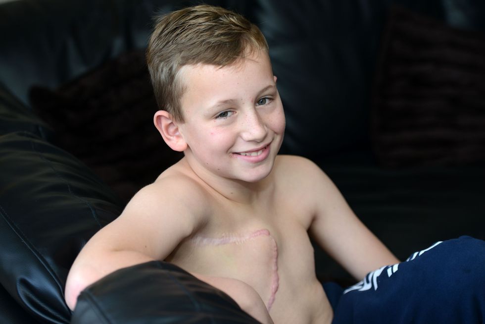 Lewis Deakin, 11-year-old boy who had mastectomy