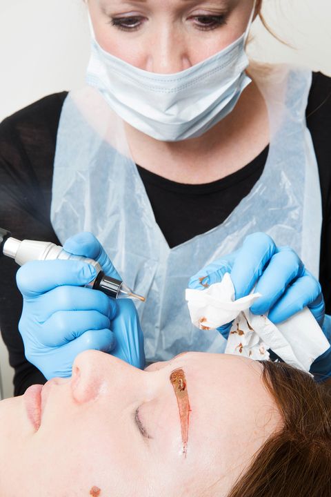 Cheek, Skin, Forehead, Eyebrow, Eyelash, Glove, Jaw, Organ, Medical procedure, Dentistry, 