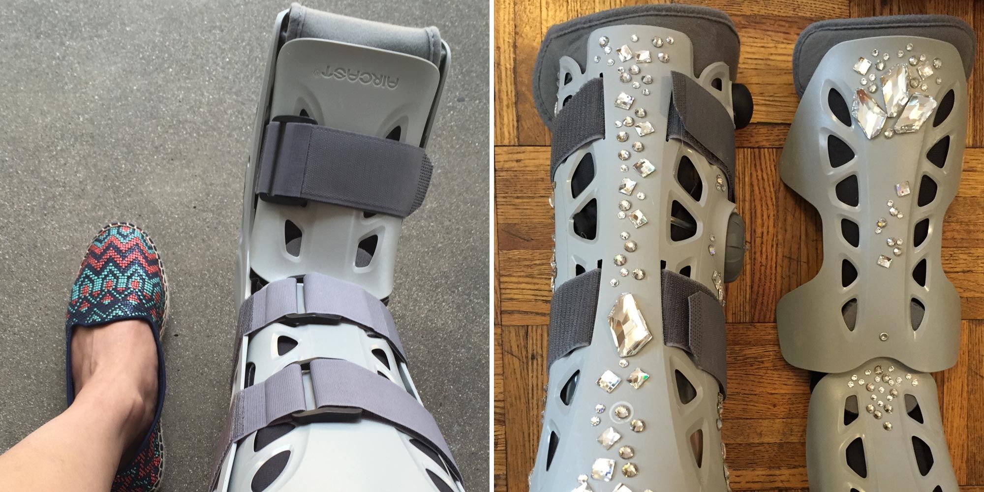 The Unexpected Thing That Happened When I Bedazzled My Cast