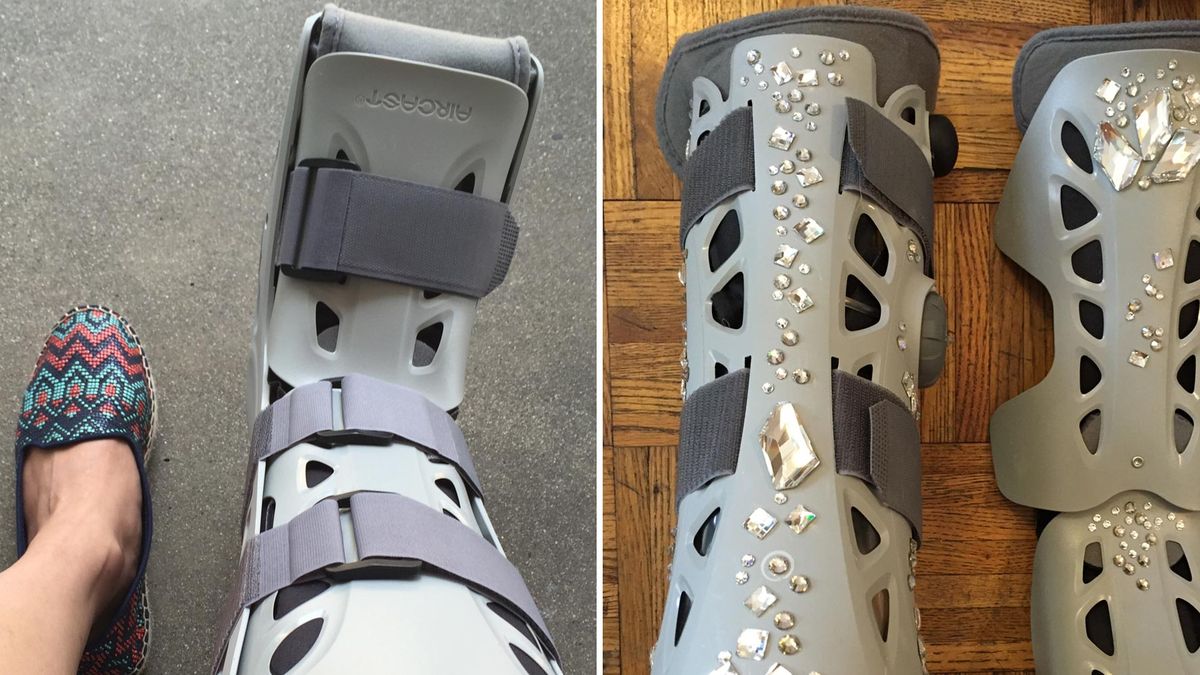 The Unexpected Thing That Happened When I Bedazzled My Cast