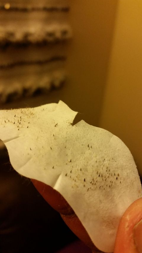 27 Grossly Satisfying Pictures of Used Pore Strips