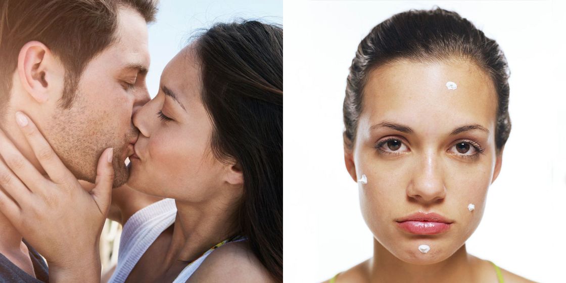 6 Ways Sex Causes Acne And What To Do About It 