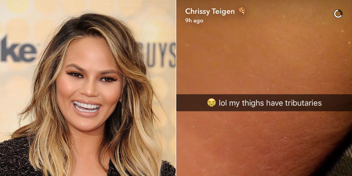 Chrissy Teigen Snapchats Her Stretch Marks Chrissy Teigen Shares Photo Of Stretch Marks 3946