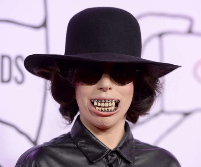 Lady Gaga Wore a Bracelet on Her Teeth Because She's Lady Gaga