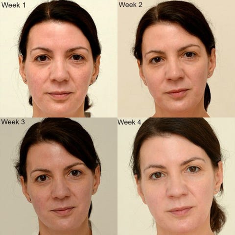 How drinking 3 litres of water can benefit skin How drinking 3 litres of water can benefit skin