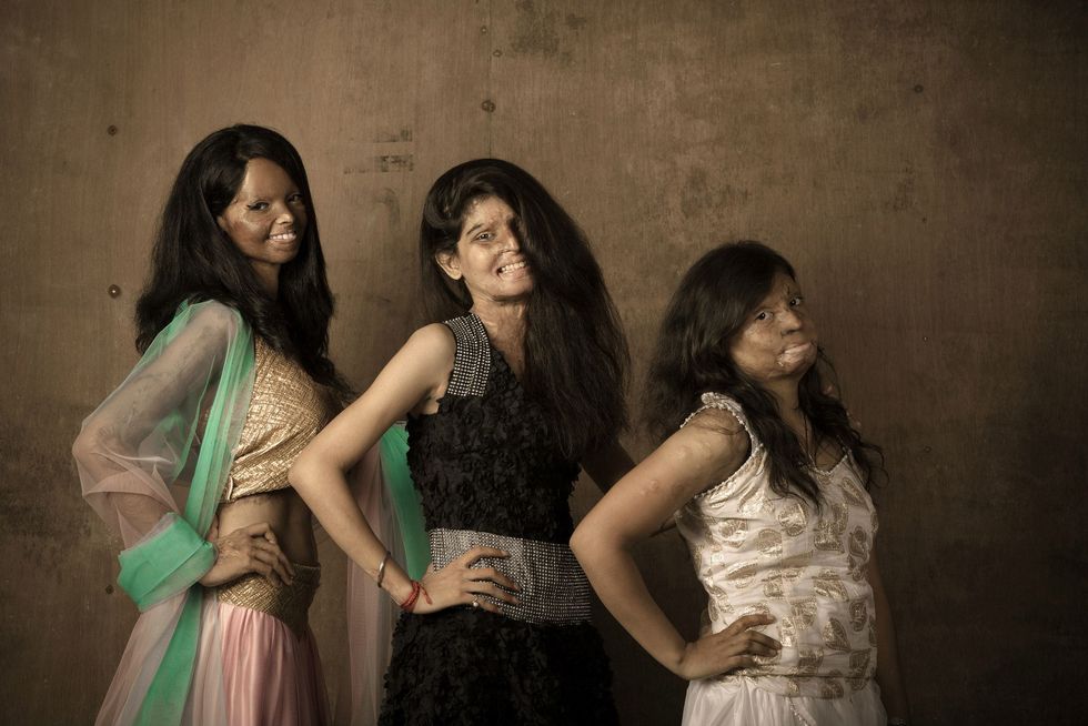 Acid attack victims India photoshoot picture 2