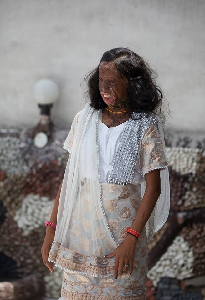 Acid attack victims India photoshoot picture 3