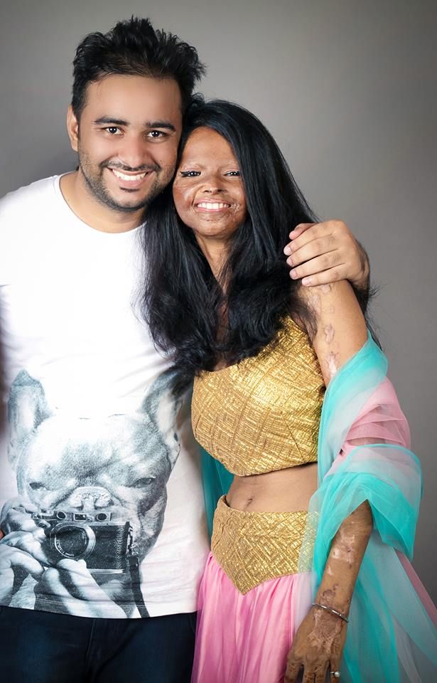 Acid attack victims India photoshoot picture 4