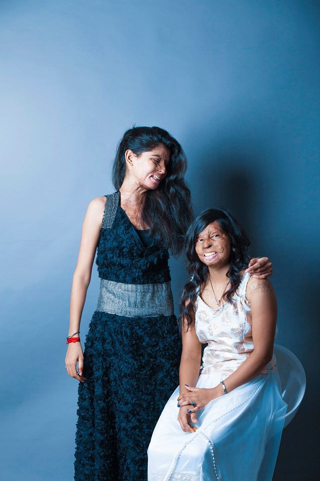 Acid attack victims India photoshoot picture 5
