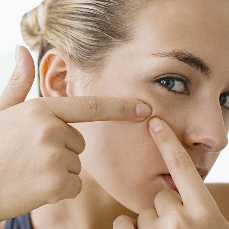 8 things that could be causing your breakouts - common causes of spots - Cosmopolitan.co.uk