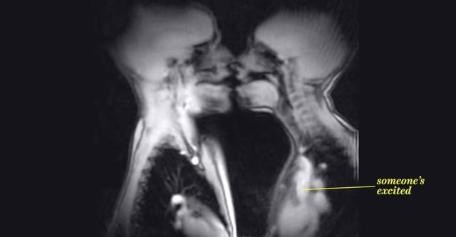 Here's an MRI scan of a couple having sex