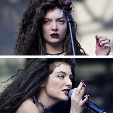 Lorde acné mauvaise peau