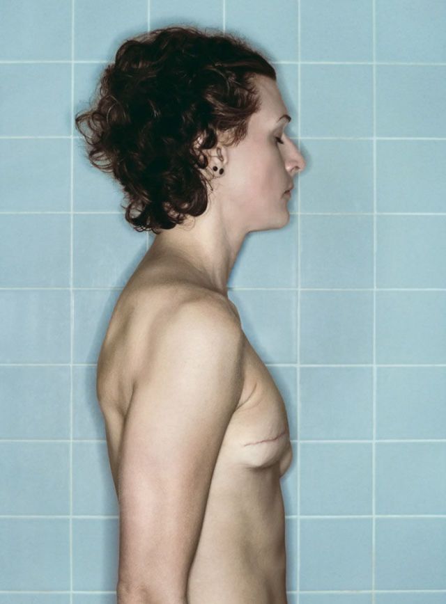 15 raw photos of a woman's breast cancer treatment